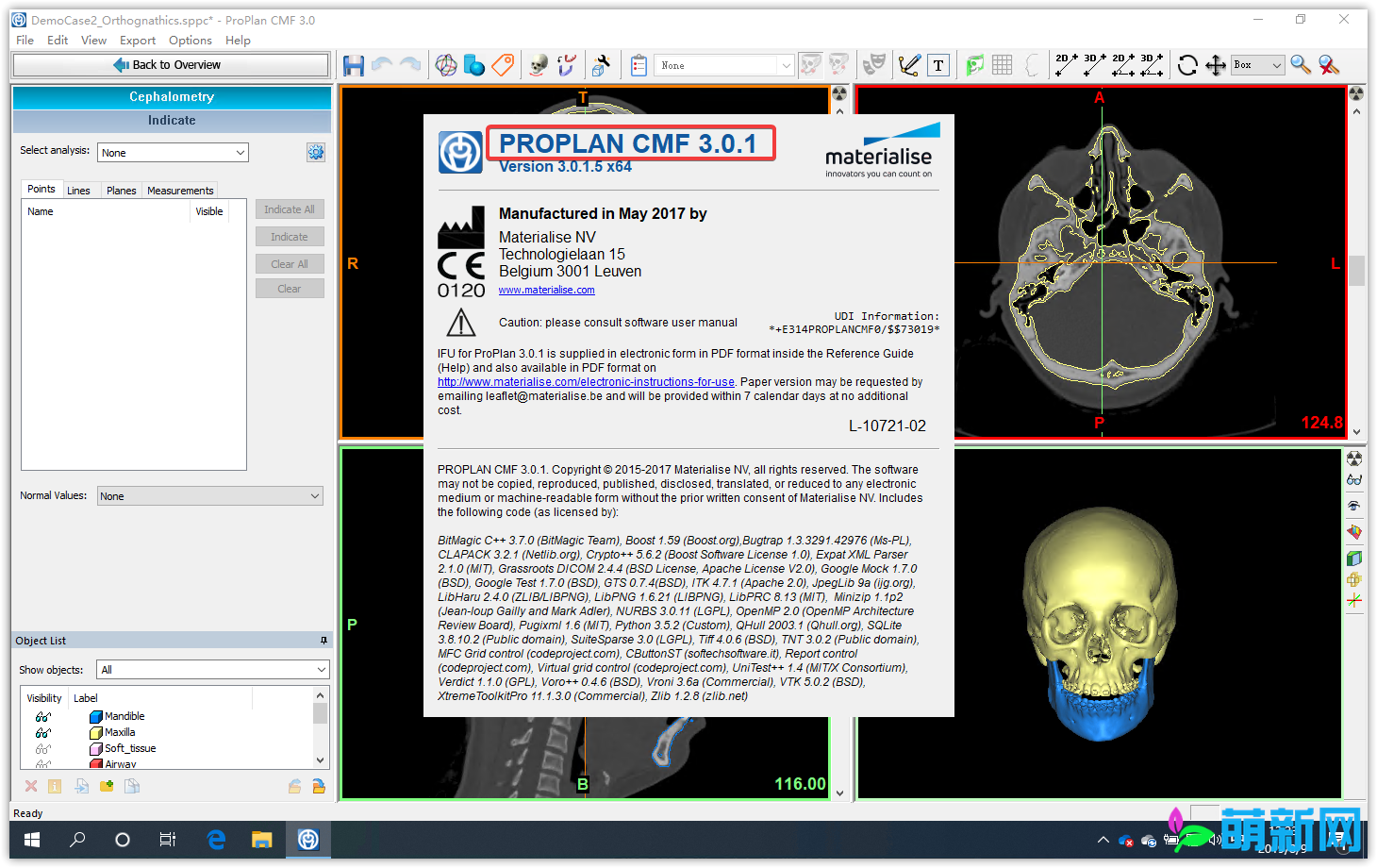Materialise ProPlan CMF v3.0.1 完美激活版 强大的医学软件下载插图