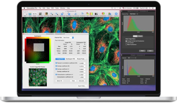 CoLocalizer Pro 5.3.1 for Mac像素定量共定位分析软件下载插图